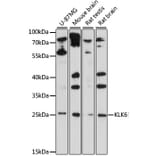 Western Blot - Anti-Kallikrein 6 Antibody (A88988) - Antibodies.com