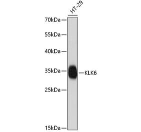 Western Blot - Anti-Kallikrein 6 Antibody (A88989) - Antibodies.com