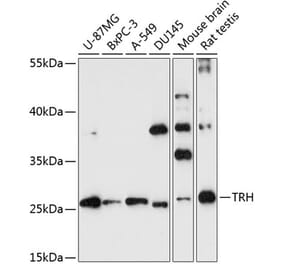 Western Blot - Anti-Thyrotropin Releasing Hormone (TRH) Antibody (A88990) - Antibodies.com