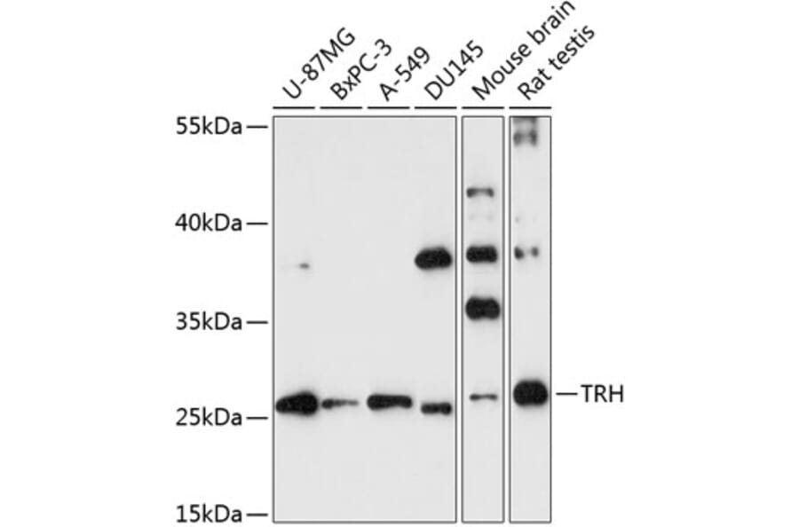 Western Blot - Anti-Thyrotropin Releasing Hormone (TRH) Antibody (A88990) - Antibodies.com