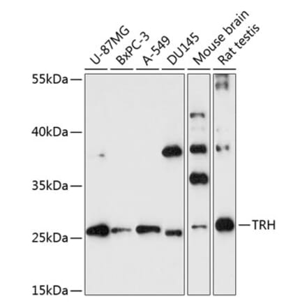 Western Blot - Anti-Thyrotropin Releasing Hormone (TRH) Antibody (A88990) - Antibodies.com