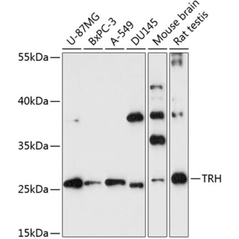 Western Blot - Anti-Thyrotropin Releasing Hormone (TRH) Antibody (A88990) - Antibodies.com