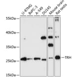 Western Blot - Anti-Thyrotropin Releasing Hormone (TRH) Antibody (A88990) - Antibodies.com