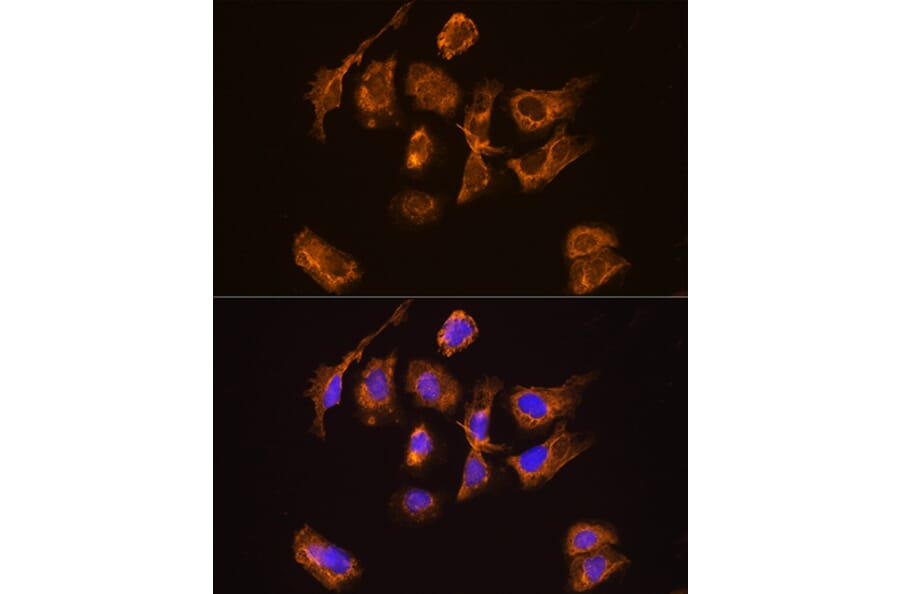 Immunofluorescence - Anti-Thyrotropin Releasing Hormone (TRH) Antibody (A88990) - Antibodies.com
