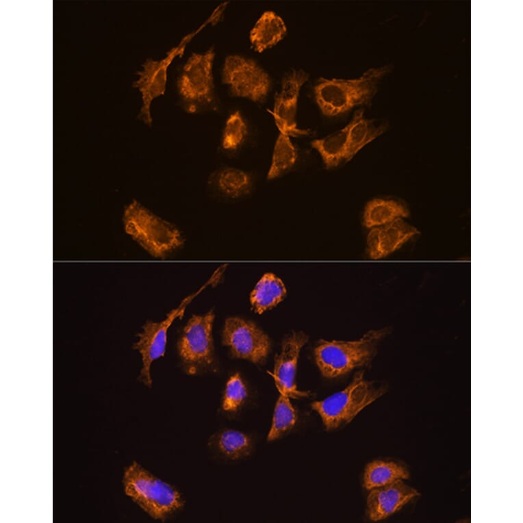 Immunofluorescence - Anti-Thyrotropin Releasing Hormone (TRH) Antibody (A88990) - Antibodies.com