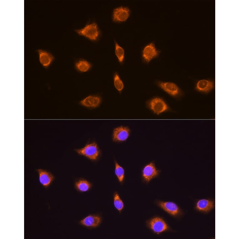 Immunofluorescence - Anti-Thyrotropin Releasing Hormone (TRH) Antibody (A88990) - Antibodies.com