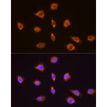 Immunofluorescence - Anti-Thyrotropin Releasing Hormone (TRH) Antibody (A88990) - Antibodies.com