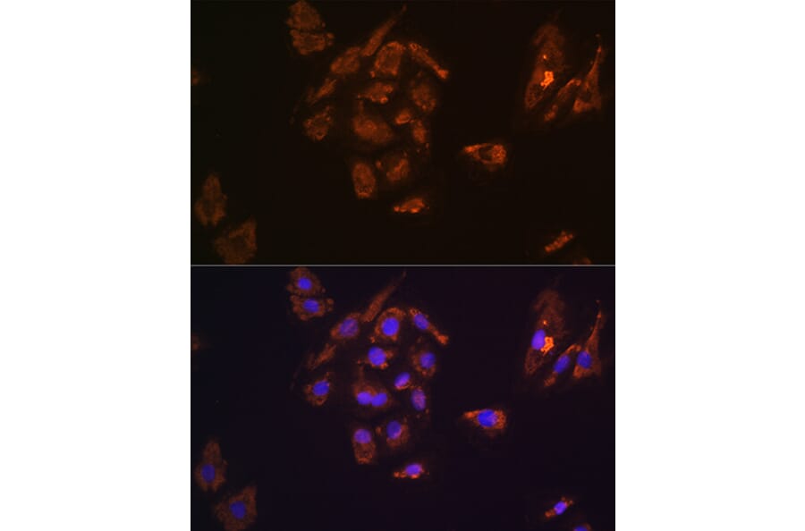 Immunofluorescence - Anti-Thyrotropin Releasing Hormone (TRH) Antibody (A88990) - Antibodies.com