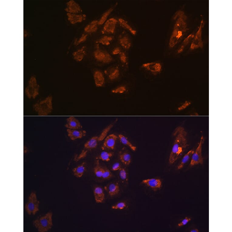 Immunofluorescence - Anti-Thyrotropin Releasing Hormone (TRH) Antibody (A88990) - Antibodies.com