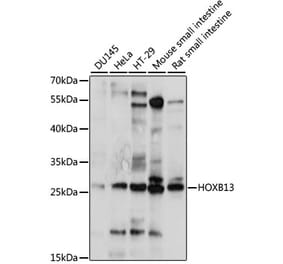Western Blot - Anti-HOXB13 Antibody (A88991) - Antibodies.com