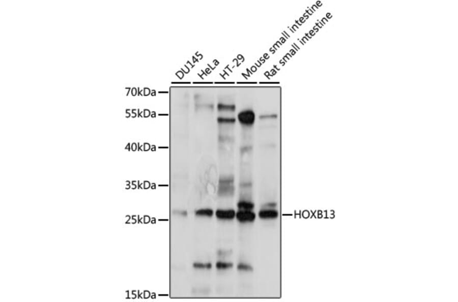 Western Blot - Anti-HOXB13 Antibody (A88991) - Antibodies.com