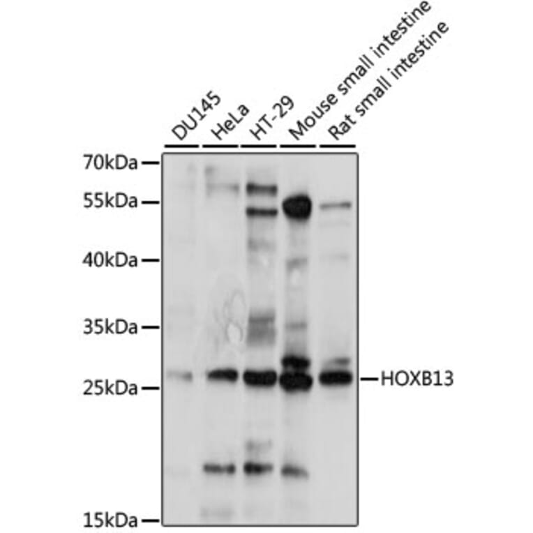 Western Blot - Anti-HOXB13 Antibody (A88991) - Antibodies.com