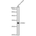 Western Blot - Anti-Insig2 Antibody (A88992) - Antibodies.com