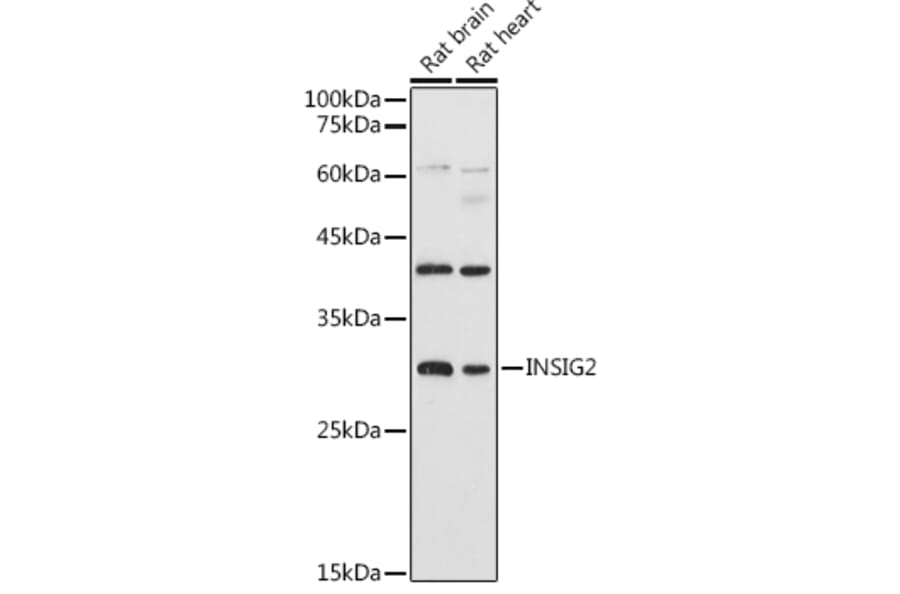 Western Blot - Anti-Insig2 Antibody (A88992) - Antibodies.com