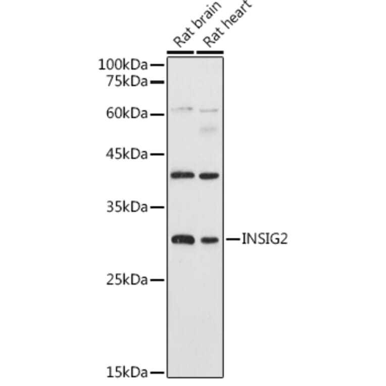 Western Blot - Anti-Insig2 Antibody (A88992) - Antibodies.com