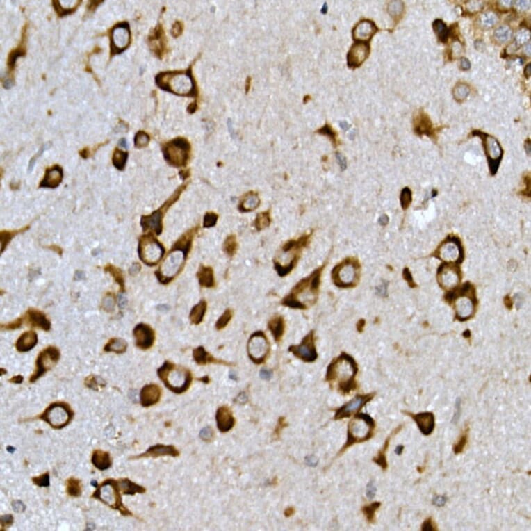 Immunohistochemistry - Anti-Insig2 Antibody (A88992) - Antibodies.com
