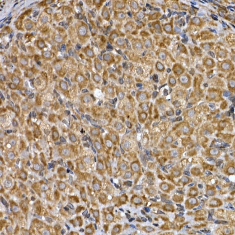Immunohistochemistry - Anti-Insig2 Antibody (A88992) - Antibodies.com