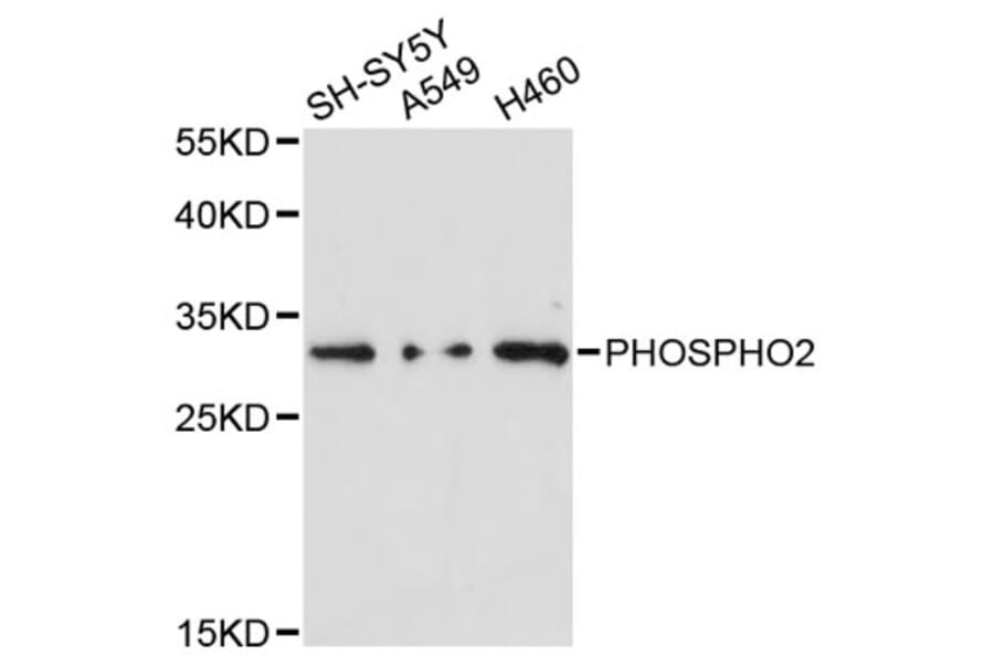 Western Blot - Anti-PHOSPHO2 Antibody (A12816) - Antibodies.com