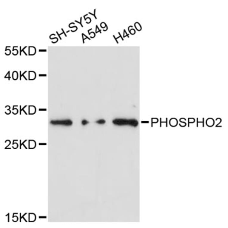Western Blot - Anti-PHOSPHO2 Antibody (A12816) - Antibodies.com