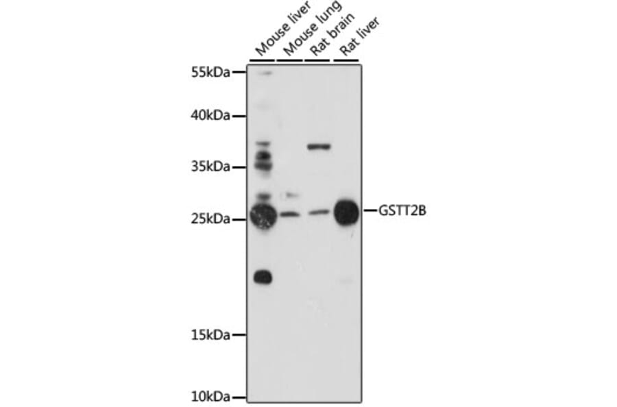Western Blot - Anti-GSTT2 Antibody (A88994) - Antibodies.com