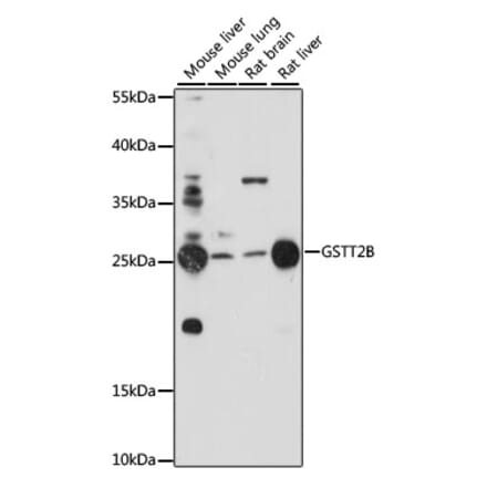 Western Blot - Anti-GSTT2 Antibody (A88994) - Antibodies.com