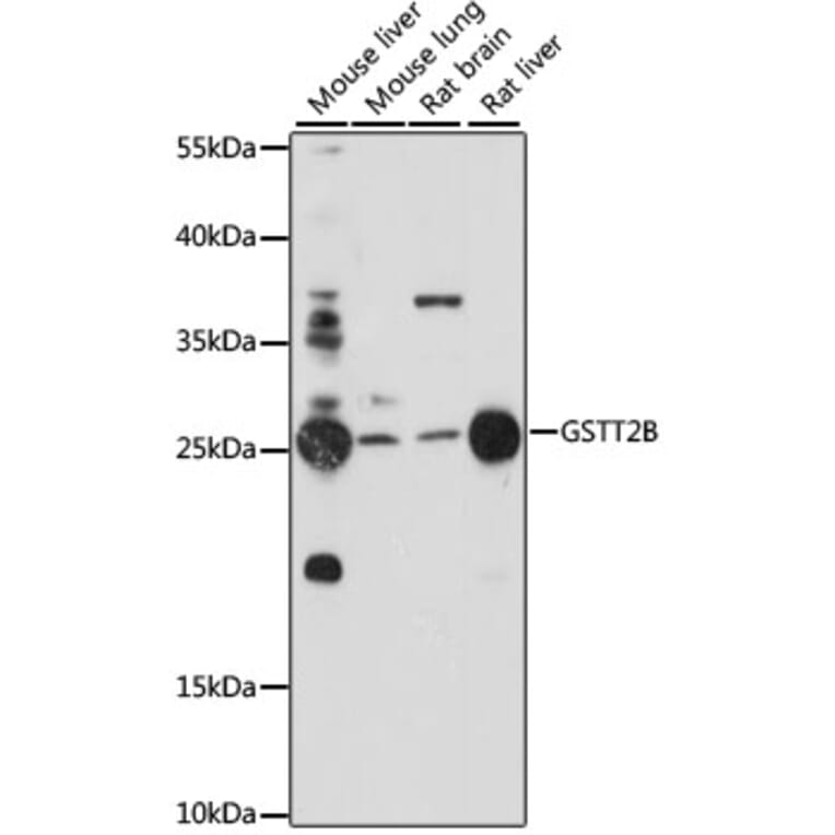 Western Blot - Anti-GSTT2 Antibody (A88994) - Antibodies.com