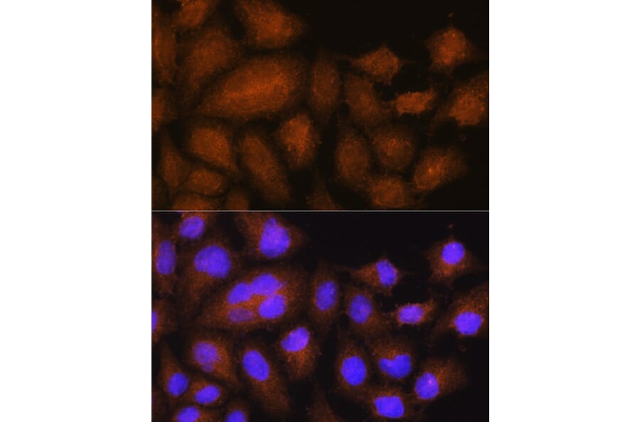 Immunofluorescence - Anti-GSTT2 Antibody (A88994) - Antibodies.com