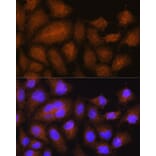 Immunofluorescence - Anti-GSTT2 Antibody (A88994) - Antibodies.com