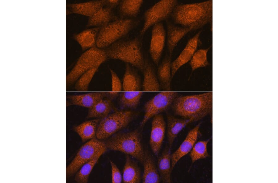 Immunofluorescence - Anti-GSTT2 Antibody (A88994) - Antibodies.com