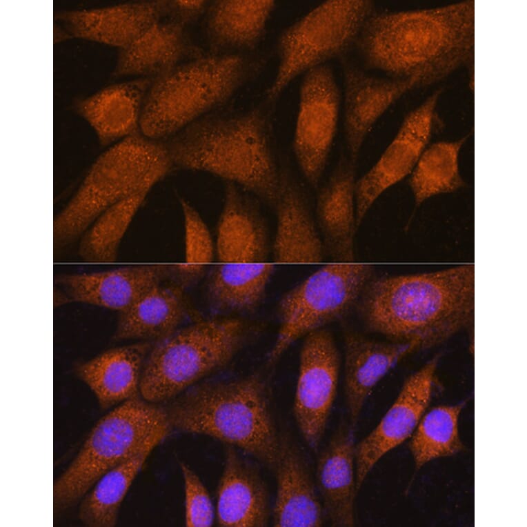 Immunofluorescence - Anti-GSTT2 Antibody (A88994) - Antibodies.com
