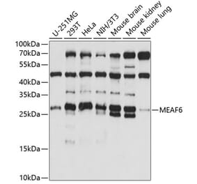 Western Blot - Anti-MEAF6 Antibody (A88995) - Antibodies.com