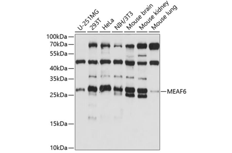 Western Blot - Anti-MEAF6 Antibody (A88995) - Antibodies.com