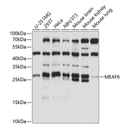 Western Blot - Anti-MEAF6 Antibody (A88995) - Antibodies.com