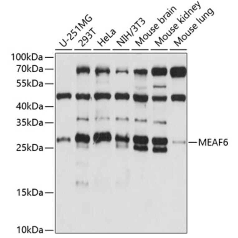 Western Blot - Anti-MEAF6 Antibody (A88995) - Antibodies.com