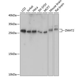 Western Blot - Anti-Zmat2 Antibody (A88996) - Antibodies.com