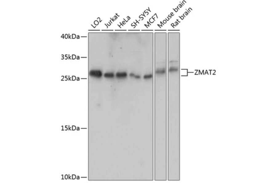 Western Blot - Anti-Zmat2 Antibody (A88996) - Antibodies.com