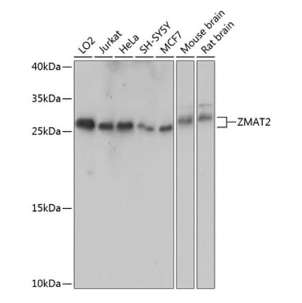Western Blot - Anti-Zmat2 Antibody (A88996) - Antibodies.com