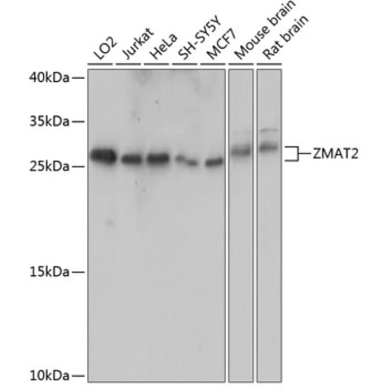 Western Blot - Anti-Zmat2 Antibody (A88996) - Antibodies.com