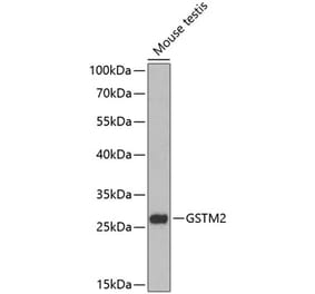 Western Blot - Anti-GSTM2 Antibody (A88997) - Antibodies.com