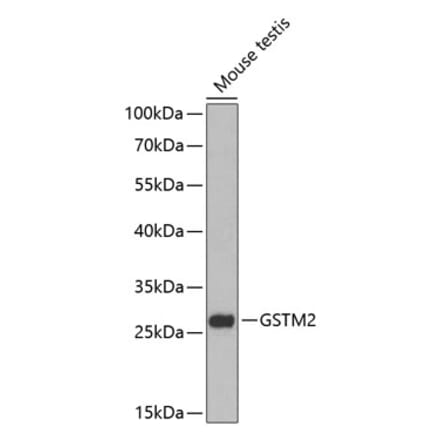 Western Blot - Anti-GSTM2 Antibody (A88997) - Antibodies.com