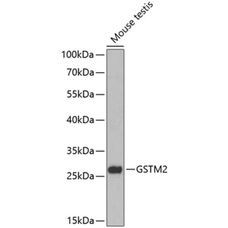 Western Blot - Anti-GSTM2 Antibody (A88997) - Antibodies.com