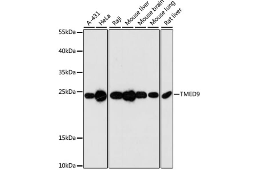 Western Blot - Anti-TMED9 Antibody (A88998) - Antibodies.com