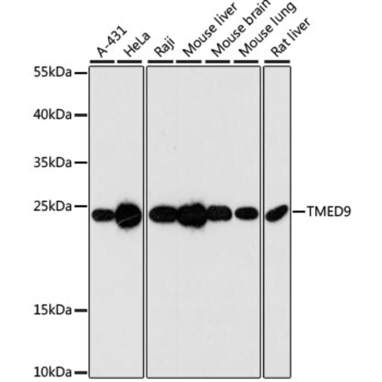 Western Blot - Anti-TMED9 Antibody (A88998) - Antibodies.com