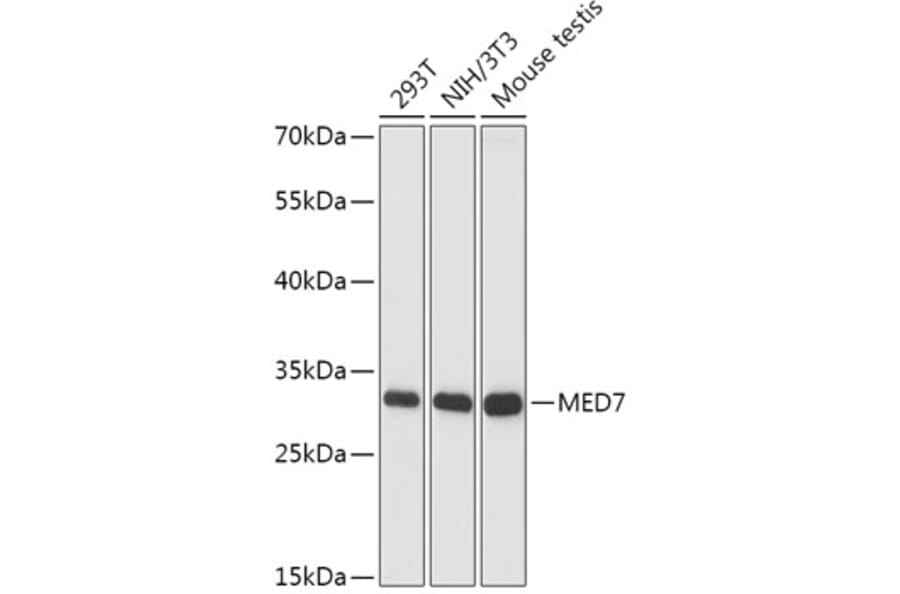 Western Blot - Anti-MED7 Antibody (A88999) - Antibodies.com