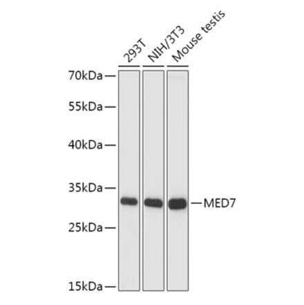 Western Blot - Anti-MED7 Antibody (A88999) - Antibodies.com