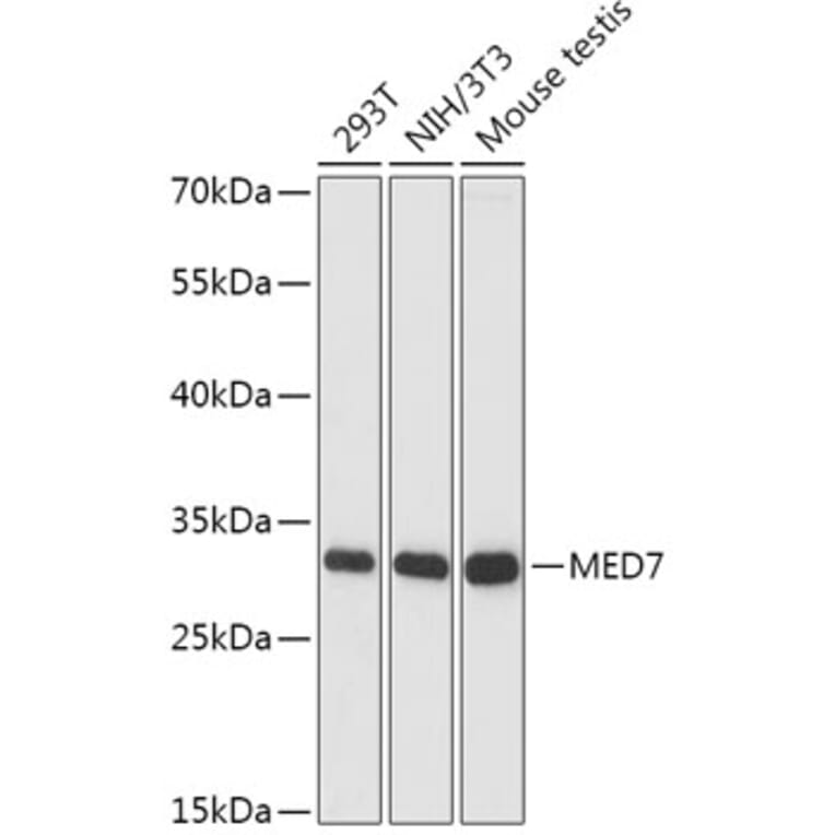 Western Blot - Anti-MED7 Antibody (A88999) - Antibodies.com