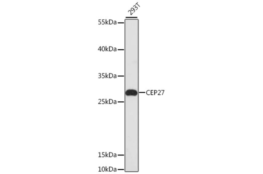 Western Blot - Anti-CEP27 Antibody (A13707) - Antibodies.com