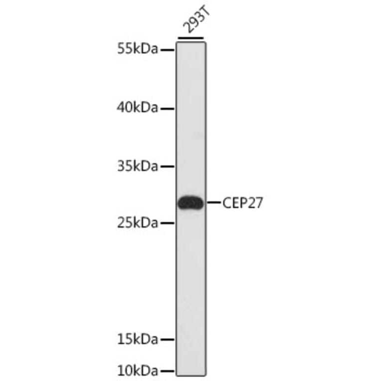 Western Blot - Anti-CEP27 Antibody (A13707) - Antibodies.com