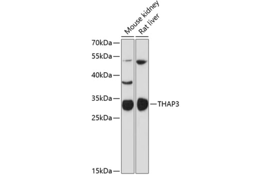 Western Blot - Anti-THAP3 Antibody (A89002) - Antibodies.com