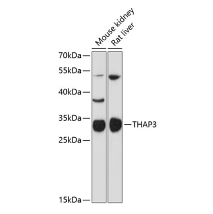 Western Blot - Anti-THAP3 Antibody (A89002) - Antibodies.com